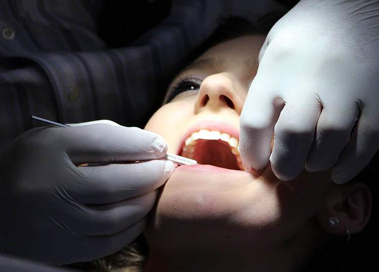 dentofobia wybielanie zębów stomatolog dentysta zęby stomatolog kamień nazębny