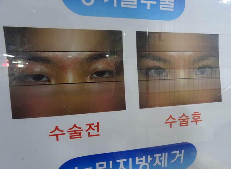 chirurgia plastyczna Korea Południowa poradnik podróże