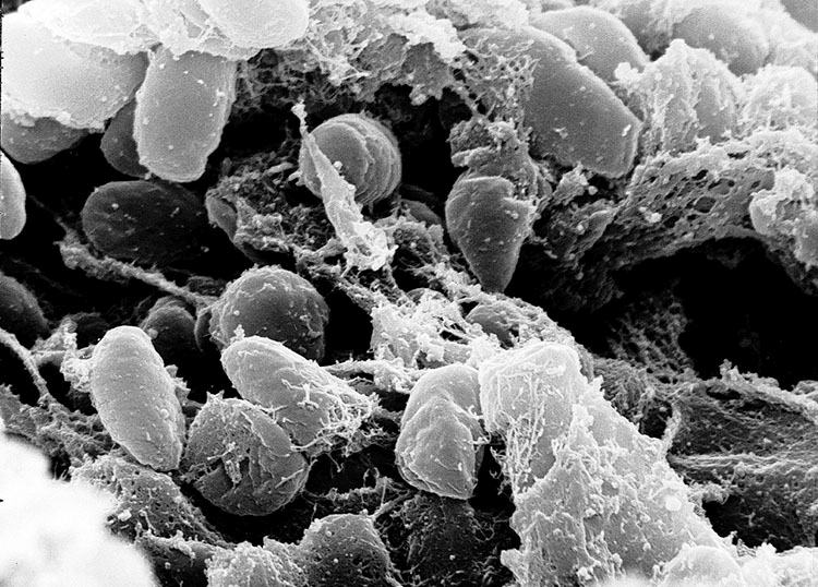 dżuma bakterie pandemia epidemia ciekawostki
