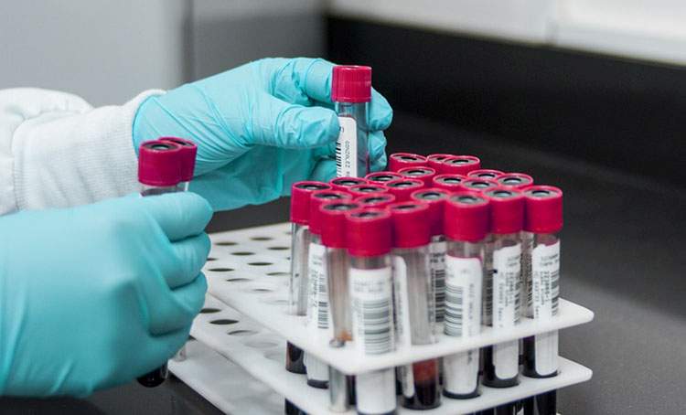 laboratorium lateksowe medyczne
